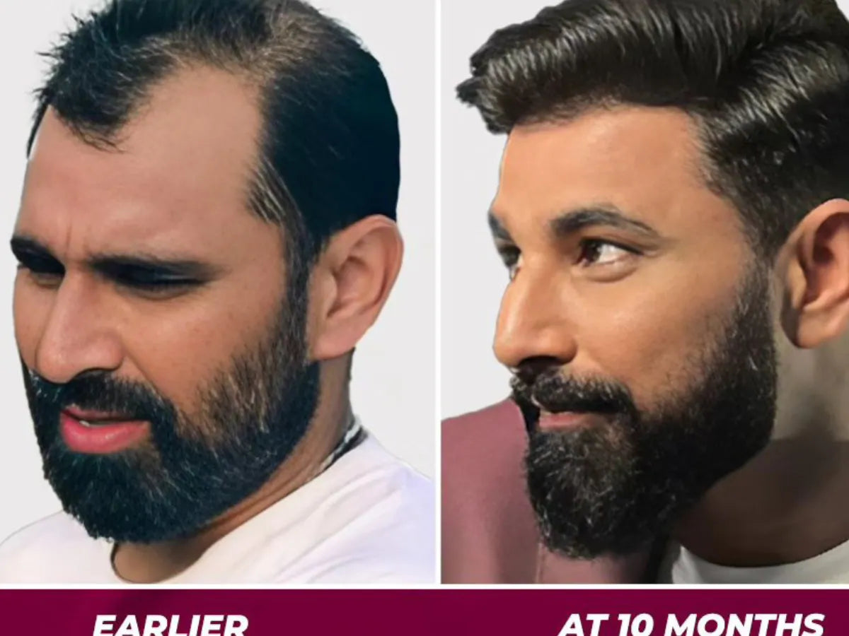 Jamalgota Ayurvedic Hair Powder Buy 1 Get 1 Free